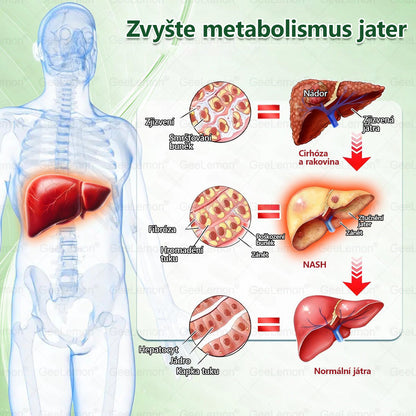 Oficiální prodejna BENU | 🎁 𝐆𝐞𝑒𝑙𝑒𝐦𝐨𝐧® Glum𝐚𝐬𝐞tide 8 v 1 – Zeštíhlující nano mikrojihlový náplast 🇨🇿 Jen 1× denně ✅ Viditelné změny za 7 dní – na obezitu, kardiovaskulární zdraví, diabetes a kloubní problémy